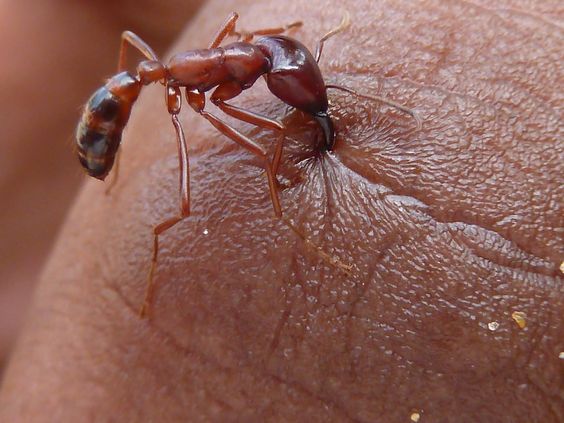 red-ant-bites