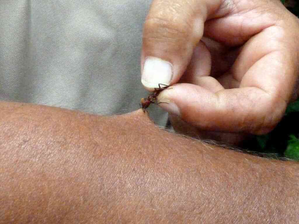 ant bite picture